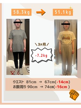 ドクターキュア 千歳船橋店(DR.CURE)/20代女性〈3ヶ月ダイエット〉