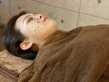 ハリトマト 梅田中崎/施術(ほうれい線・浮腫施術)