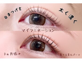 アイアンド(i&)/マイラミネーション