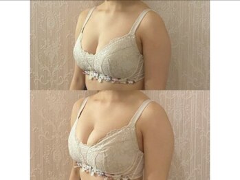 ジョリー(Jolie)/