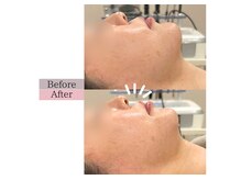 フロリール アザブジュウバン(FlorirAzabujuban)/人中短縮