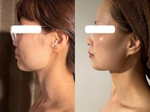 カシェット(cachette)