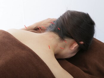 げんき堂整体院 ララガーデン長町店の写真/「いつもの辛さ」を諦めない。根本原因へアプローチする鍼灸施術で、皆様の生活をサポートします！