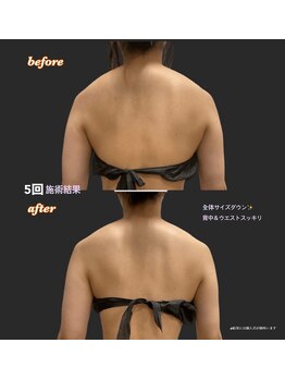 メンズアンドレディース エステティックサロン ティアラ(TiaLa)/エステと矯正のコラボです！！