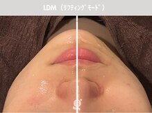 グレイスリリー 表参道(gracelily)/韓美人目指すならLDM！