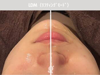 グレイスリリー 表参道(gracelily)/韓美人目指すならLDM！