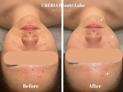 クレヴィア バイ サイバーエステ(CREBIA)の写真