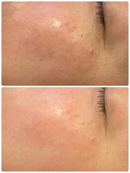 ニジ(Nizi)/毛穴をきゅっと引き締め肌へ