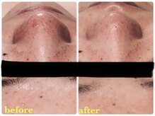 ベルドア(Bell Door)/【色むら/シミケア】