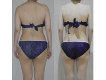 アルマ 芦屋(ALMA)/ただ痩せるだけじゃ満足できない