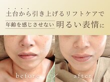 ココアールの雰囲気（リフトUpと同時にツヤ、透明感のある美肌を叶えます！）