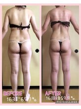 エステティックリラクゼーション フォーユー(for 悠)/驚きの変化！