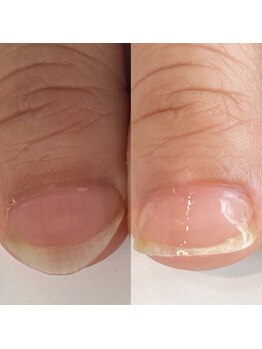 ルクレール カシェット(Le clair cachette)/美爪育成コース