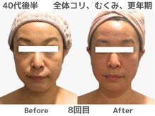 マテリアル 痩身骨気サロン(MATERIAL)の雰囲気（体整えたら顔も小さくなった！「顔のたるみは身体から変わる」）