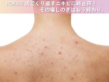 ロエヴェ(ROEWE)の雰囲気（背中ニキビ・毛穴ケアは素肌専門店で。ブライダルでも大人気♪）