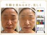 夏に加速するたるみ・シワを徹底ケア◎紫外線に負けない上向きツヤ肌へ