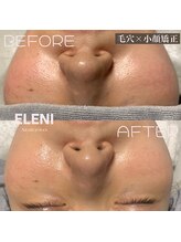 エレーニ 麻布十番(ELENI)/毛穴×頭蓋骨小顔矯正｜加工なし