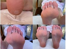 ビサンテ サロン/角質ケア＆角質育成ケア-2