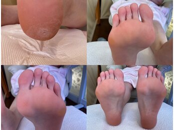 ビサンテ サロン/角質ケア&角質育成ケア-2