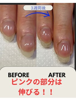 ブルームブルーム(BLOOMブルーム)/爪のピンクの部分は伸びる!