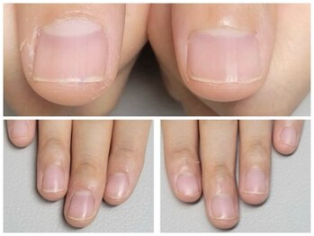 グレースレディ 神戸北店/