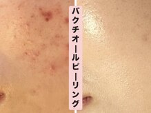 ザ エステティック福岡