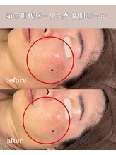 ソルニコン(Solnikon)/赤み・くすみクリア♪