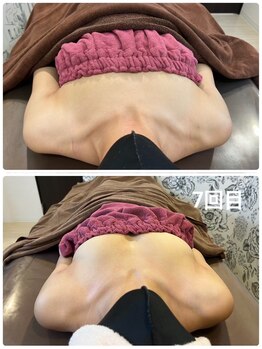 ロココ 豊田店(Rococo)/ビフォーアフター