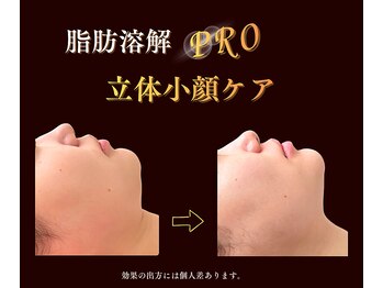 チェインオブフラワー 都島(CHAIN OF FLOWER)/すっきり♪立体小顔ケア