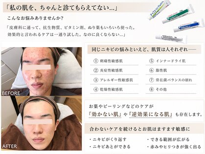 ビアンカの写真