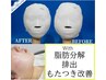 ★輪郭・顔セル脂肪★【リボーン小顔コルギ＋脂肪分解６cc】顔セル脂肪分解