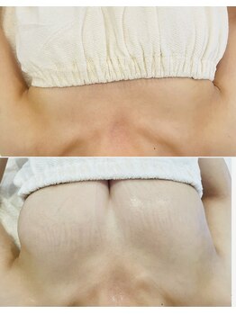 メゾン アンジュ(Maison Ange)/【C→F バストアップ症例】