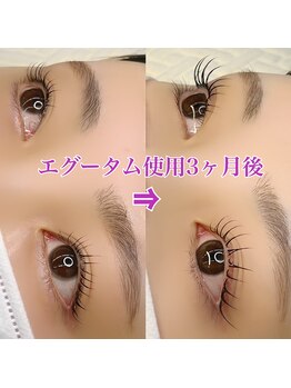 ベリー(BERRY)/エグータム3ヶ月使用