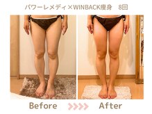 リトリト(Retreat)/8回ビフォアフター