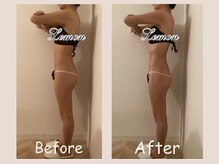 レモン(Lemon)/ビフォーアフター