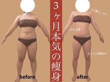 モア 星ヶ丘店(MORE)/お客様ビフォーアフター