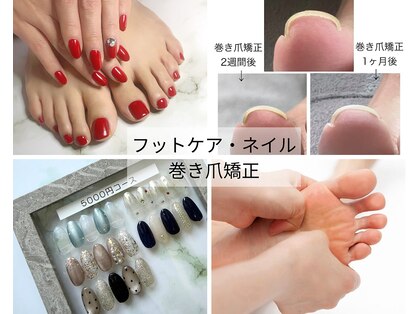 アオラ(Aola)の写真