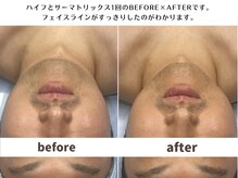 韓美 表参道店(HANMI)/サーマトリックス[表参道]