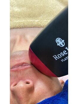 エステサロン オパール(OPALE)/プラチナビーム脱毛