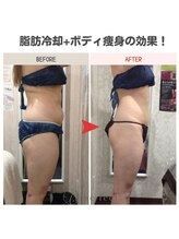 ビーフィール 横浜店(be feel)/お腹周りの頑固な脂肪もスッキリ