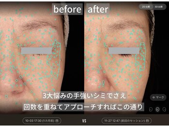 ダイヤモンドトゥルース(Diamond truth)/徹底美白でシミに働きかける