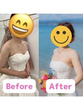 ボディキュア ブライダル美容整体 大阪梅田/美デコルテ×美バスト/大阪/梅田