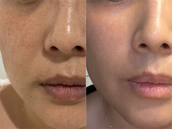 プライベートサロン ラウレア(Laule'a)/