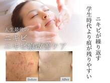 エピア 岡崎店(Epia)