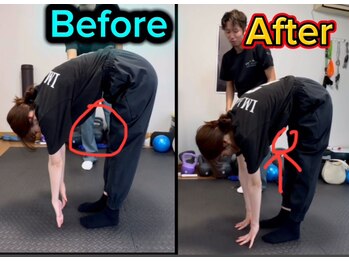 エンジョイエクササイズ整体院 武蔵新城(enjoyEXERCISE整体院)/Before、After