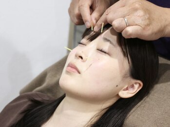 みのり鍼灸整骨院【肩こり/腰痛/小顔美容鍼/眼精疲労/自律神経/整体/睡眠/肩甲骨】の写真/【PC・スマホの重い眼精疲労に】鍼灸×頭皮鍼で目の奥の奥までアプローチ!クリアな視界と軽い頭へ