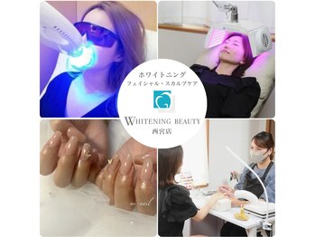 ホワイトニングビューティー 西宮店