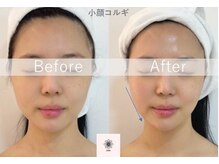 ルナビューティー 赤坂(LUNA beauty)/《韓国式本格小顔コルギ》