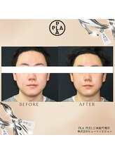 アドラーブル プレ葉ウォーク浜北店/メンズにも！ プラピール　