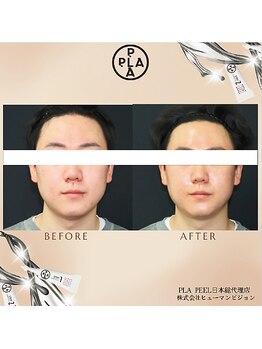 アドラーブル プレ葉ウォーク浜北店/メンズにも！ プラピール　